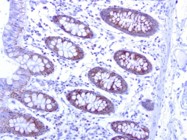 MRPS34 Antibody in Immunohistochemistry (Paraffin) (IHC (P))