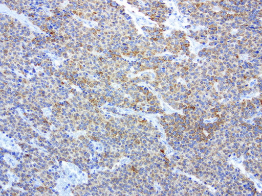 MRPS34 Antibody in Immunohistochemistry (Paraffin) (IHC (P))