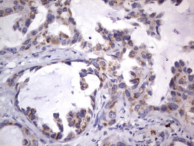 MRPS7 Antibody in Immunohistochemistry (Paraffin) (IHC (P))