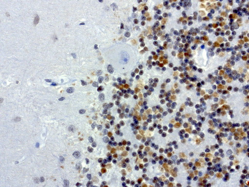 MRPS7 Antibody in Immunohistochemistry (Paraffin) (IHC (P))