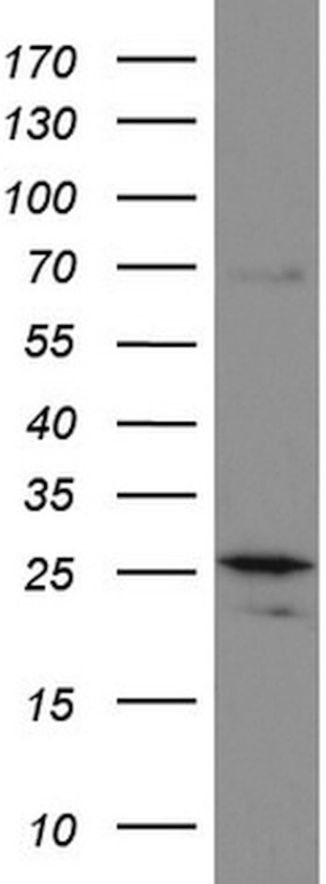 MRPS7 Antibody in Western Blot (WB)