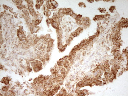 MRRF Antibody in Immunohistochemistry (Paraffin) (IHC (P))