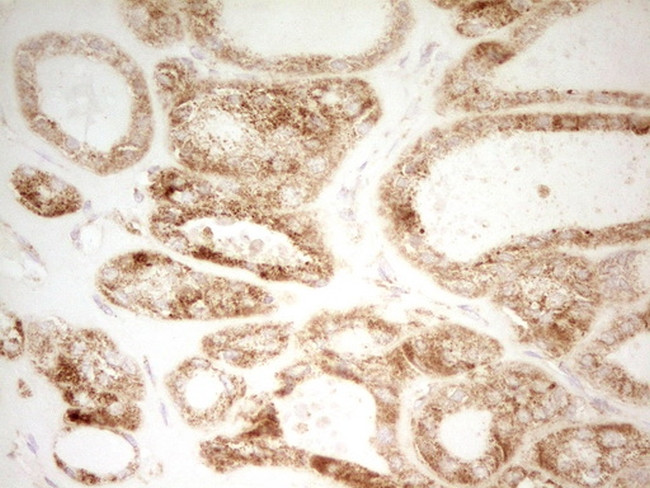 MRRF Antibody in Immunohistochemistry (Paraffin) (IHC (P))