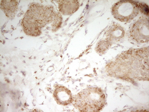 MRRF Antibody in Immunohistochemistry (Paraffin) (IHC (P))