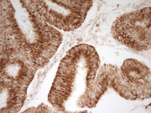 MRRF Antibody in Immunohistochemistry (Paraffin) (IHC (P))