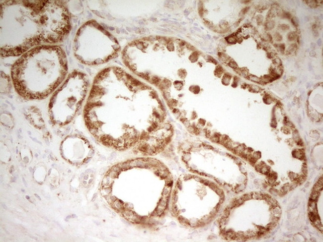 MRRF Antibody in Immunohistochemistry (Paraffin) (IHC (P))