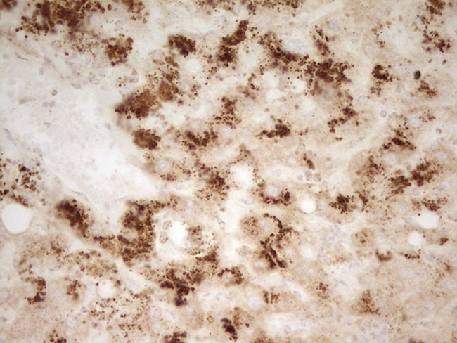 MRRF Antibody in Immunohistochemistry (Paraffin) (IHC (P))