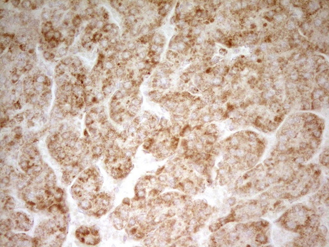 MRRF Antibody in Immunohistochemistry (Paraffin) (IHC (P))