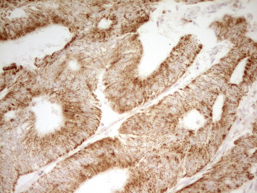 MRRF Antibody in Immunohistochemistry (Paraffin) (IHC (P))