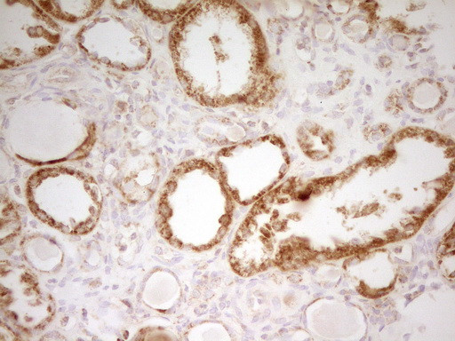 MRRF Antibody in Immunohistochemistry (Paraffin) (IHC (P))