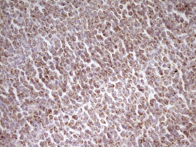 MRRF Antibody in Immunohistochemistry (Paraffin) (IHC (P))