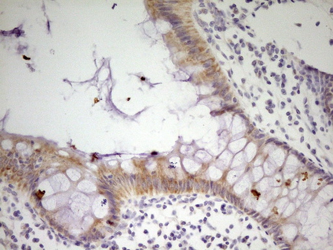 MRRF Antibody in Immunohistochemistry (Paraffin) (IHC (P))