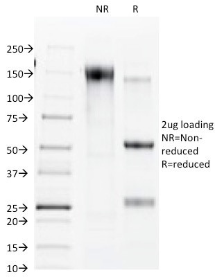 Connexin 32 (Gap Junction Protein) Antibody in SDS-PAGE (SDS-PAGE)