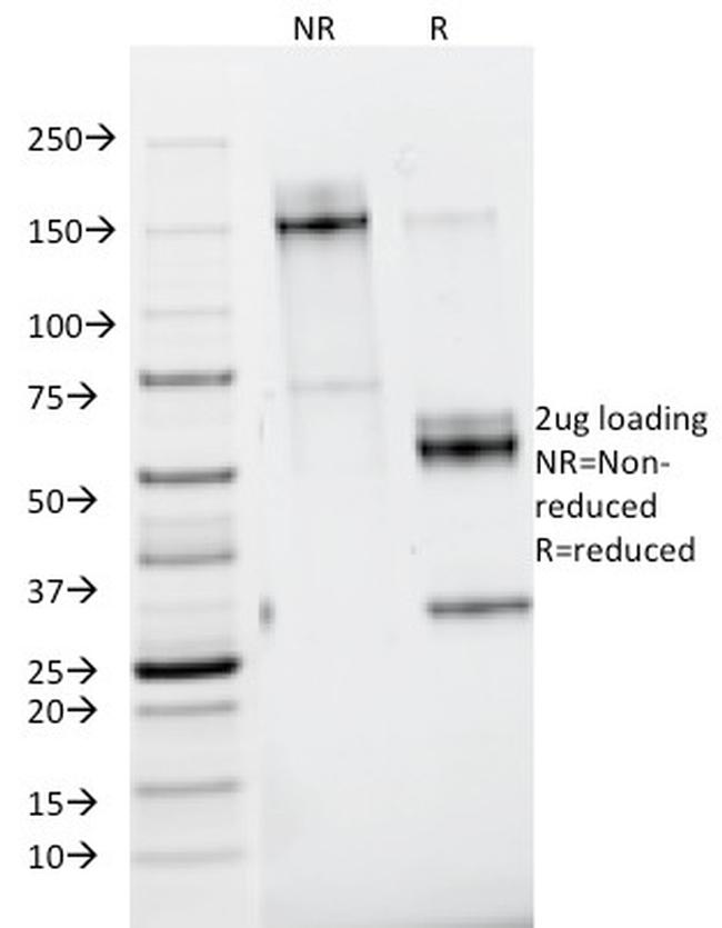 Nidogen/Entactin Antibody in Immunoelectrophoresis (IE)