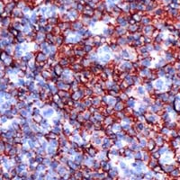 CD20 Antibody in Immunohistochemistry (Paraffin) (IHC (P))