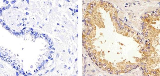 TIMP1 Antibody in Immunohistochemistry (Paraffin) (IHC (P))