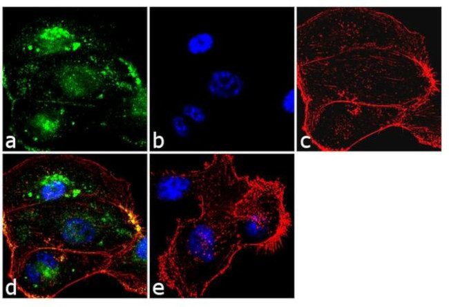 TIMP1 Antibody in Immunocytochemistry (ICC/IF)