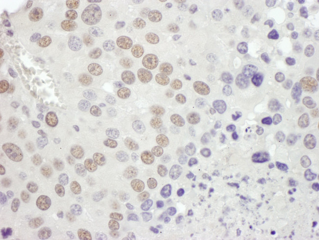 MSH2 Antibody in Immunohistochemistry (IHC)