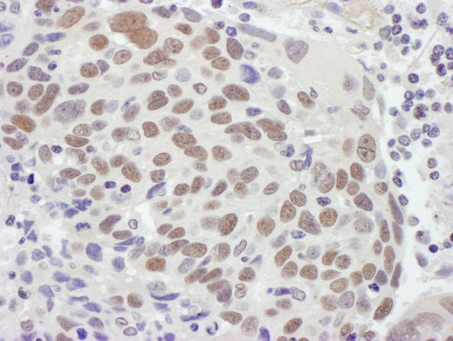 MSH2 Antibody in Immunohistochemistry (IHC)