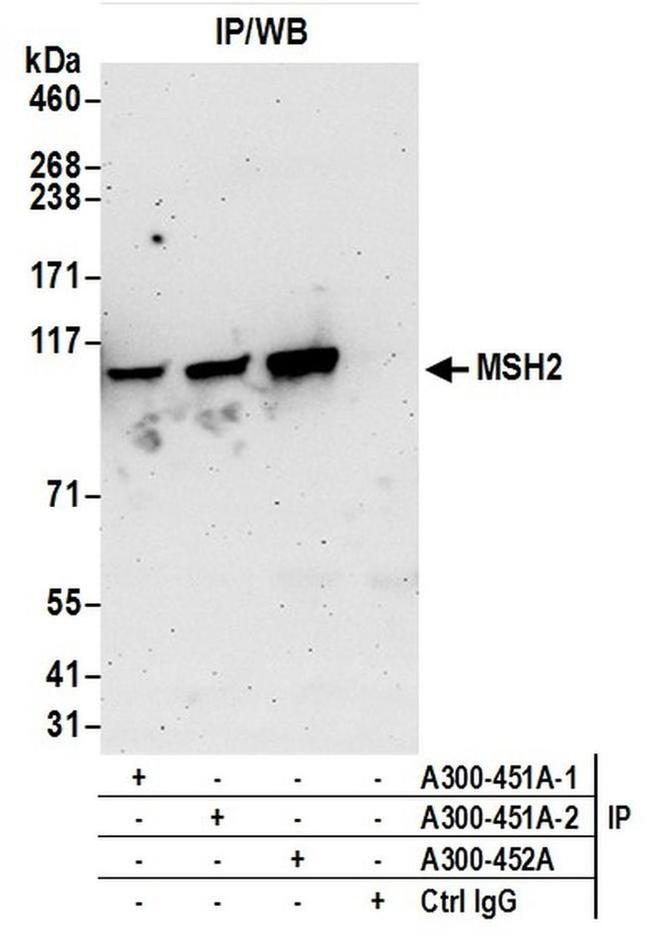 MSH2 Antibody in Western Blot (WB)