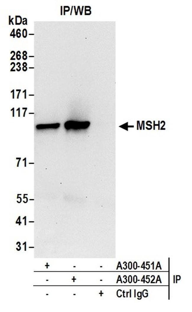 MSH2 Antibody in Western Blot (WB)