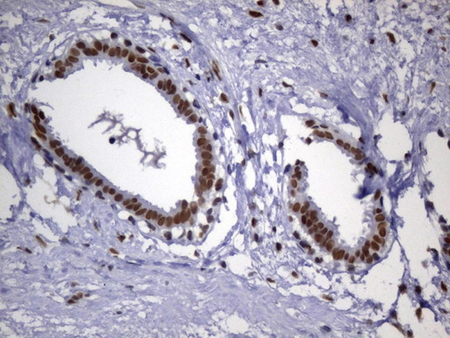 MSH2 Antibody in Immunohistochemistry (Paraffin) (IHC (P))