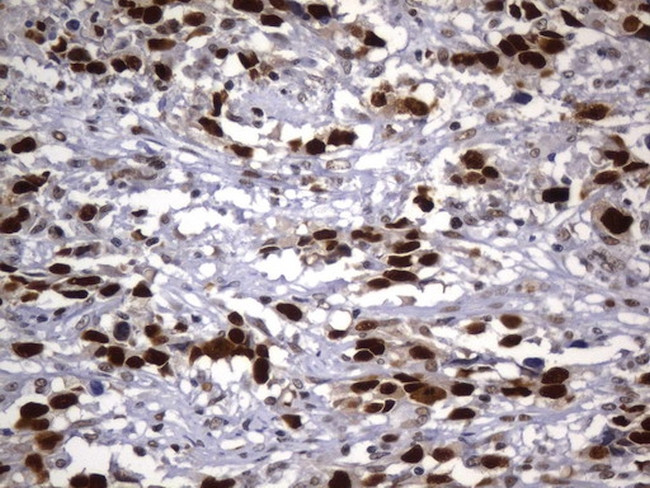 MSH2 Antibody in Immunohistochemistry (Paraffin) (IHC (P))