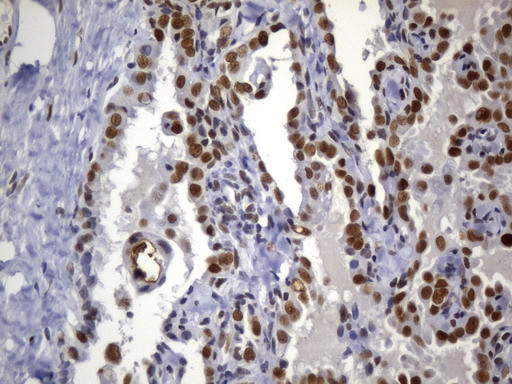 MSH2 Antibody in Immunohistochemistry (Paraffin) (IHC (P))