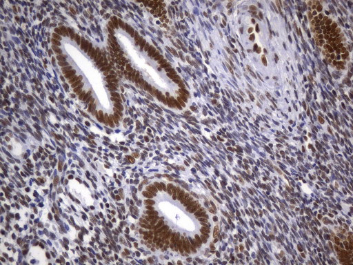 MSH2 Antibody in Immunohistochemistry (Paraffin) (IHC (P))