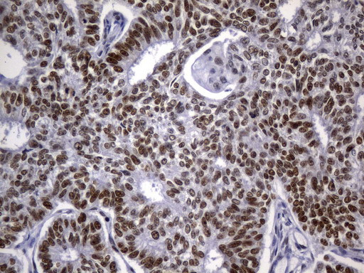 MSH2 Antibody in Immunohistochemistry (Paraffin) (IHC (P))