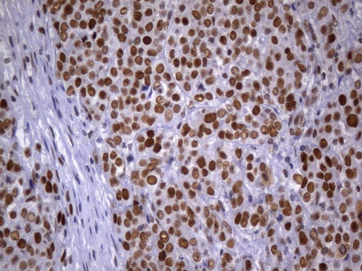 MSH2 Antibody in Immunohistochemistry (Paraffin) (IHC (P))