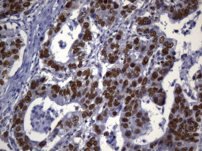 MSH2 Antibody in Immunohistochemistry (Paraffin) (IHC (P))