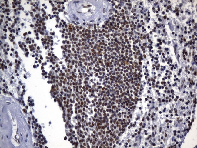 MSH2 Antibody in Immunohistochemistry (Paraffin) (IHC (P))