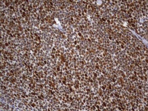 MSH2 Antibody in Immunohistochemistry (Paraffin) (IHC (P))