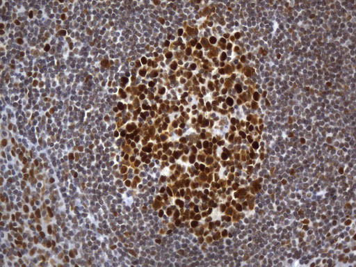 MSH2 Antibody in Immunohistochemistry (Paraffin) (IHC (P))