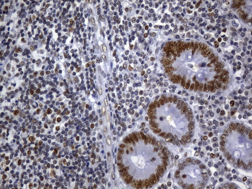 MSH2 Antibody in Immunohistochemistry (Paraffin) (IHC (P))