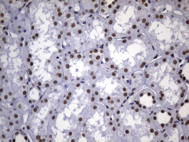 MSH2 Antibody in Immunohistochemistry (Paraffin) (IHC (P))