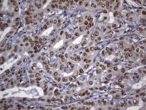 MSH2 Antibody in Immunohistochemistry (Paraffin) (IHC (P))