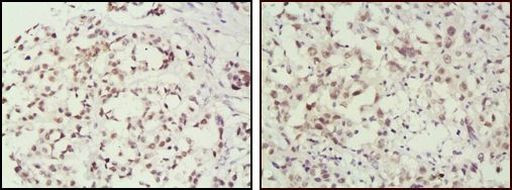 MSH2 Antibody in Immunohistochemistry (Paraffin) (IHC (P))