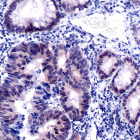 MSH2 Antibody in Immunohistochemistry (Paraffin) (IHC (P))