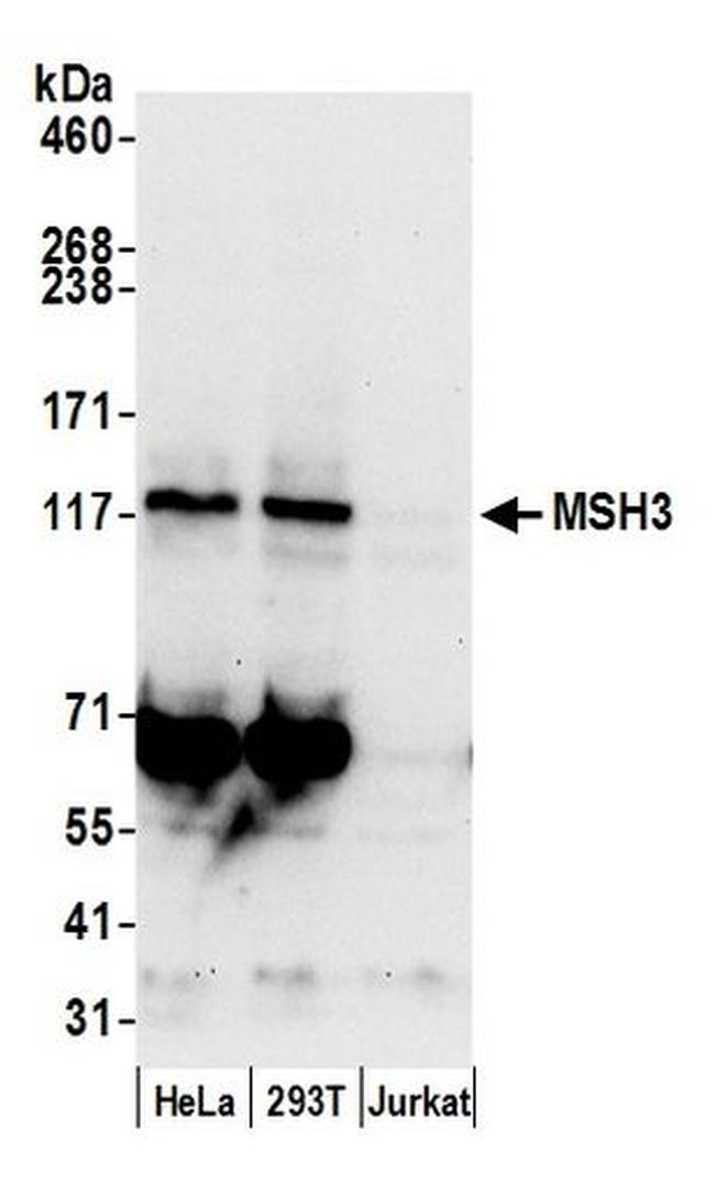 MSH3 Antibody in Western Blot (WB)