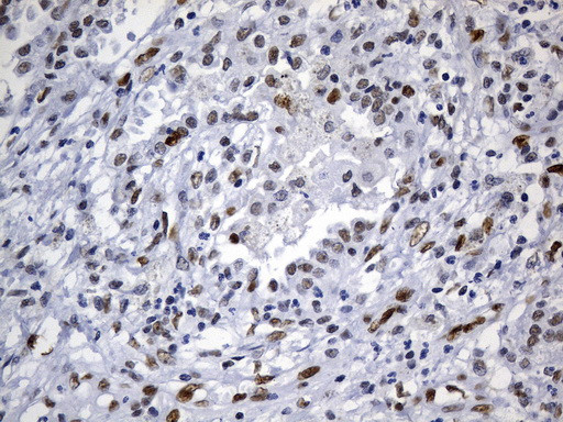 MSH6 Antibody in Immunohistochemistry (Paraffin) (IHC (P))