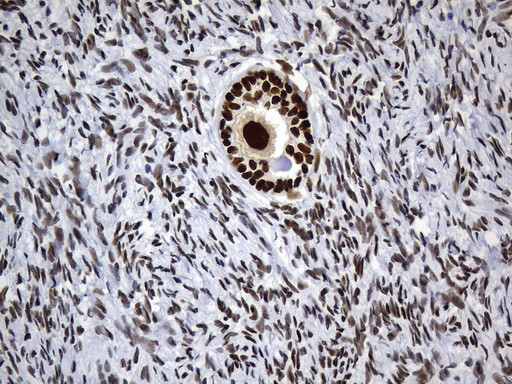 MSH6 Antibody in Immunohistochemistry (Paraffin) (IHC (P))