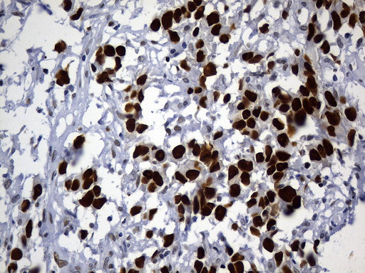 MSH6 Antibody in Immunohistochemistry (Paraffin) (IHC (P))