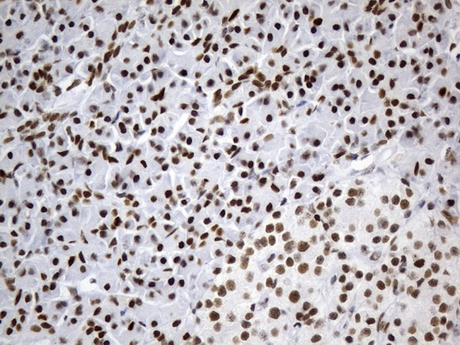 MSH6 Antibody in Immunohistochemistry (Paraffin) (IHC (P))