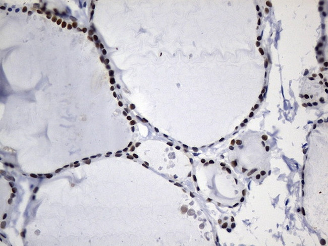 MSH6 Antibody in Immunohistochemistry (Paraffin) (IHC (P))