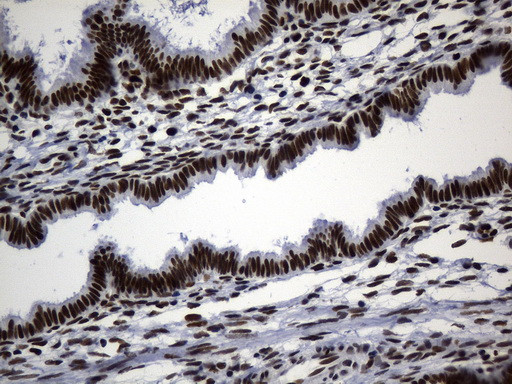 MSH6 Antibody in Immunohistochemistry (Paraffin) (IHC (P))