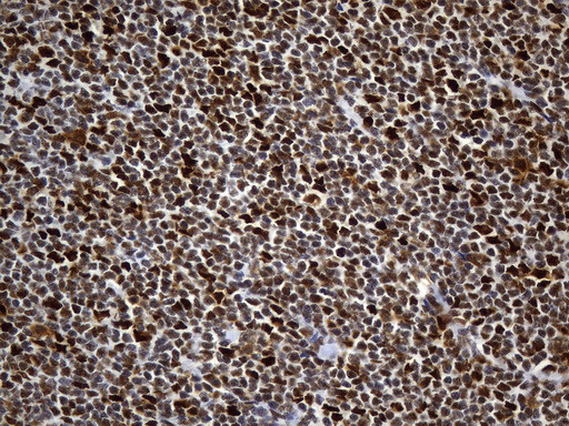 MSH6 Antibody in Immunohistochemistry (Paraffin) (IHC (P))