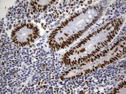 MSH6 Antibody in Immunohistochemistry (Paraffin) (IHC (P))