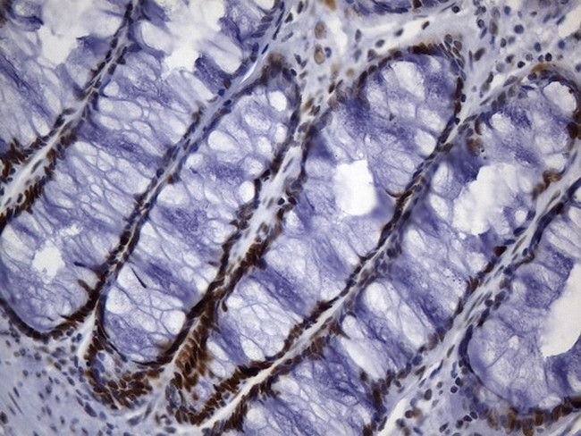 MSH6 Antibody in Immunohistochemistry (Paraffin) (IHC (P))